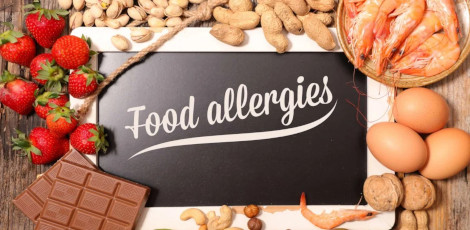 Be aware and avoid these foods that can cause food allergies, take care!!