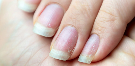 Do you know - The issue of weak nails can be due to the lack of these important nutrients!!