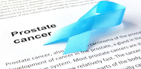 Important things to know about prostate cancer in males!!