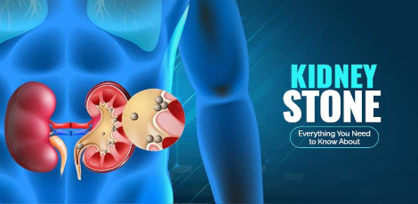 Reduce kidney stones problem by eating these superb foods!!