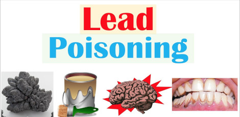 Are you aware of these important signs of lead poisoning in us?