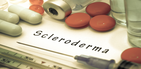 Scleroderma, an autoimmune issue - Important things to know!!