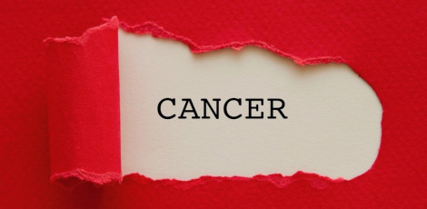 Fasting frequently could reduce the chances of getting cancers!!