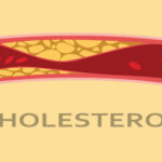 Relationship between yellow coloured growths on the eyelids and heart attacks etc - A simple method to treat high cholesterol levels at home!!